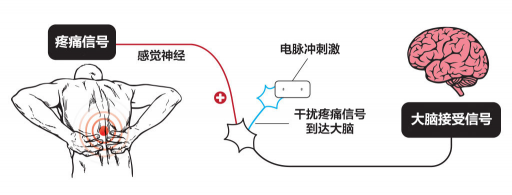 【ZE科普】一樣是電，為什么名字如此花哨