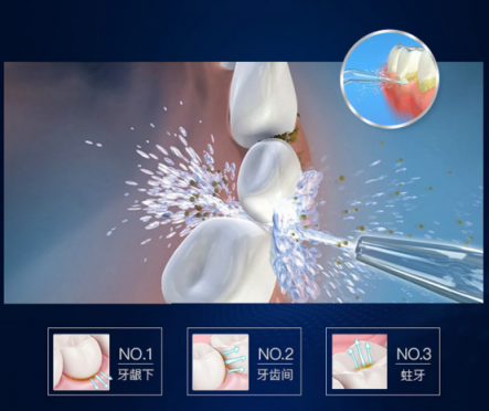 光靠刷牙解決不了牙齒困擾！沖牙器排行榜幫助你
