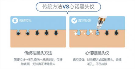 雙11最值得入手的面部清潔電器！美國心諾黑頭儀價格直降一半！