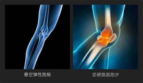 小米眾籌首款智能折疊跑步機來襲，讓愛跑步的人有“地”放矢