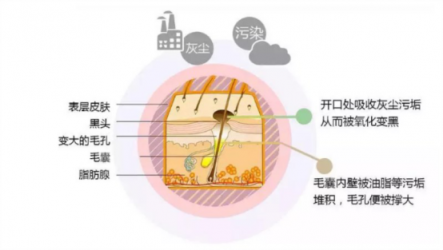 讓你的黑頭全退散！黑頭儀有用嗎？