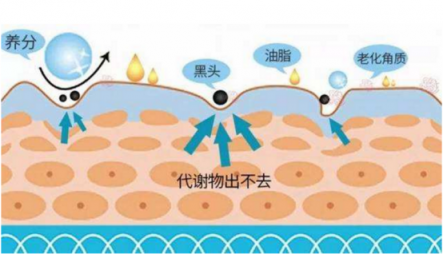 去掉黑頭你就是下一個(gè)林志玲！黑頭儀哪個(gè)牌子好？