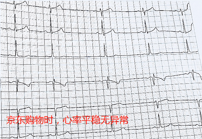 618網(wǎng)購(gòu)致老人多次心率異常 ?醫(yī)生提示要選有保障的網(wǎng)購(gòu)平臺(tái)