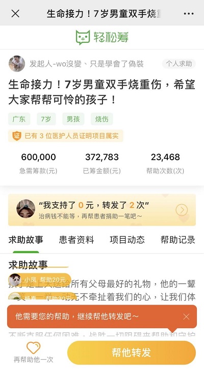 生命接力！輕松籌上愛心匯聚，幫助被生父燒傷的可憐男童重獲新生