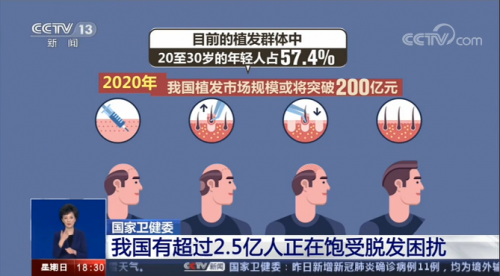 嘉興新生植發(fā)：中國脫發(fā)人群超2.5 億人 3D植發(fā)效果受認(rèn)可