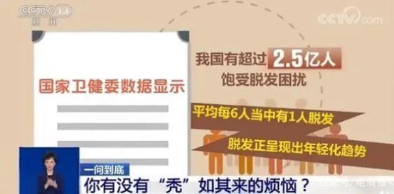 平均每5個(gè)成年人中就有1位脫發(fā) 昆明新生3D植發(fā)備受歡迎