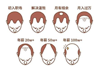 2.5億人被脫發(fā)困擾？Rogaine培健實力生發(fā)