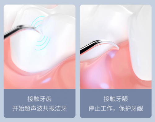 小米有品眾籌近3萬(wàn)人瘋搶！素諾智能可視潔牙儀T11 Pro成網(wǎng)紅爆款