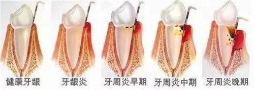 小米有品眾籌超10000000！素諾智能可視潔牙儀T11Pro為何一炮而紅？