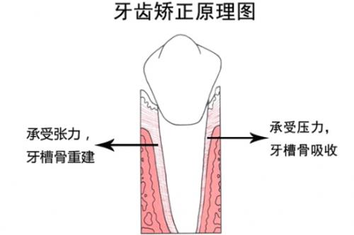 3D數(shù)字化模型矯牙“神器”，讓你不懼年齡“矯”傲逆襲