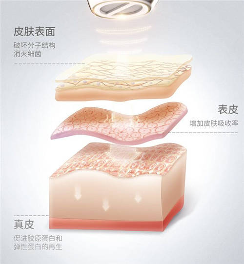 COSBEAUTY可思美專注研發(fā)，新品等離子凈膚儀憑實(shí)力圈粉