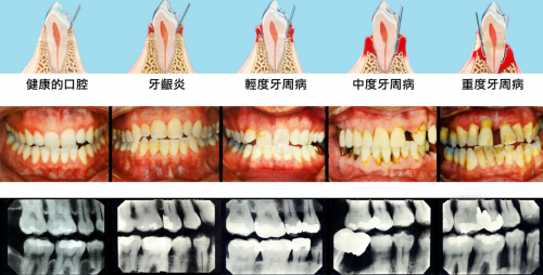 8月5日小米有品眾籌！素諾智能可視沖牙器C3 pro倒計時海報曝光