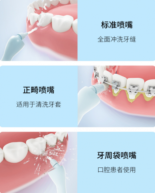 眾籌價僅269元！素諾智能可視沖牙器C3 pro小米有品眾籌開搶