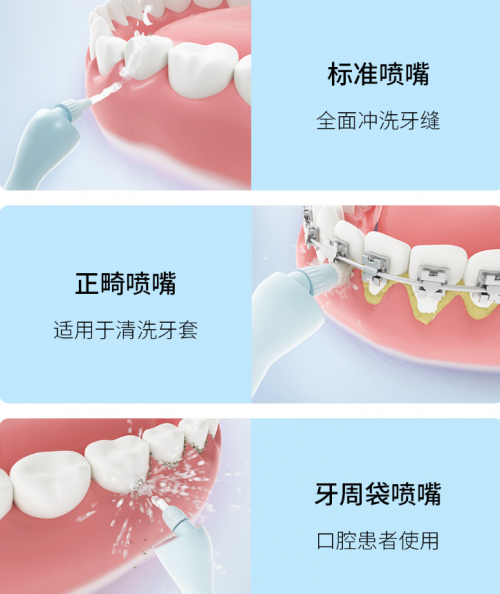 正畸人士福音！素諾智能可視沖牙器C3 pro看得清，沖得凈