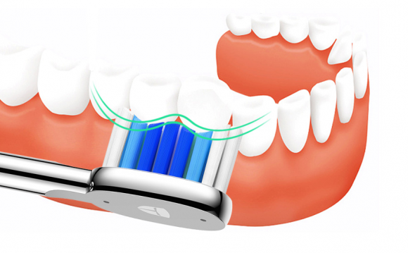 電動牙刷哪個牌子好？想解決這4大問題的請對號入座