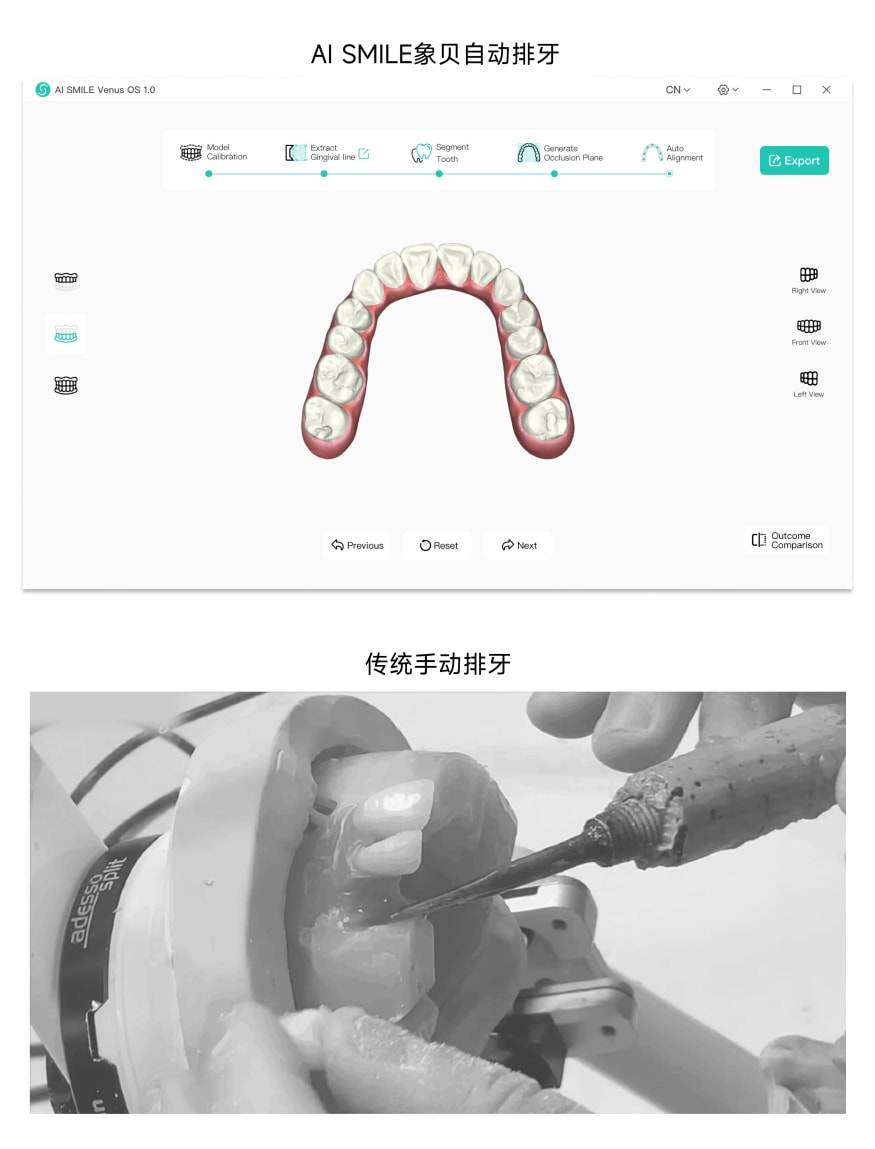 獨(dú)角獸地位盡顯！象貝AI正畸排牙系統(tǒng)Venus1.0發(fā)布 開(kāi)辟數(shù)字化牙科新紀(jì)元