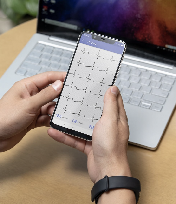 華米科技首款 Amazfit 可穿戴動態(tài)心電記錄儀問世 進軍可穿戴醫(yī)療領(lǐng)域