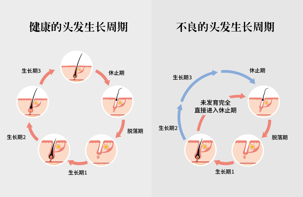 拯救頭頂大事，采用創(chuàng)新配方REDENICAL的DR ZERO來(lái)到中國(guó)