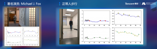 騰訊醫(yī)療人工智能研究院院長范偉：超越認(rèn)知，AI重塑運(yùn)動(dòng)評估