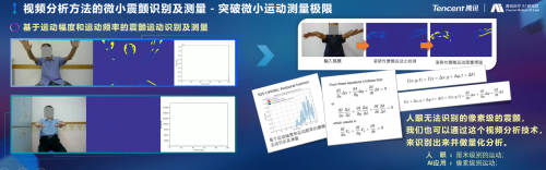 騰訊醫(yī)療人工智能研究院院長范偉：超越認(rèn)知，AI重塑運(yùn)動(dòng)評估