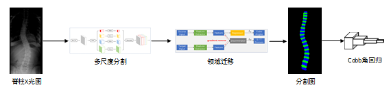 斬獲2019 MICCAI AASCE第一，騰訊優(yōu)圖醫(yī)療AI再獲突破