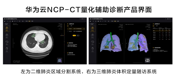 華為云推出新冠肺炎AI輔助診斷服務(wù)，疫情期間免費(fèi)對(duì)定點(diǎn)收治醫(yī)院開(kāi)放