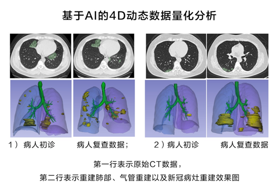 華為云推出新冠肺炎AI輔助診斷服務(wù)，疫情期間免費(fèi)對(duì)定點(diǎn)收治醫(yī)院開(kāi)放