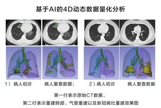 非常時期下的城市防控、生產(chǎn)與治理，華為云用AI“全鏈條“戰(zhàn)疫