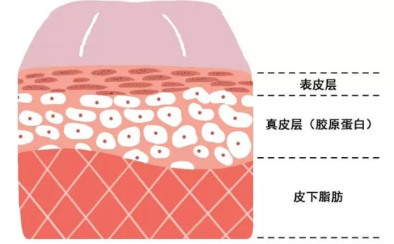 不做表面功夫，潤(rùn)致娃娃針+分層抗衰讓你年齡滿40減20